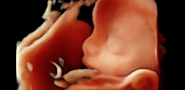 bebe